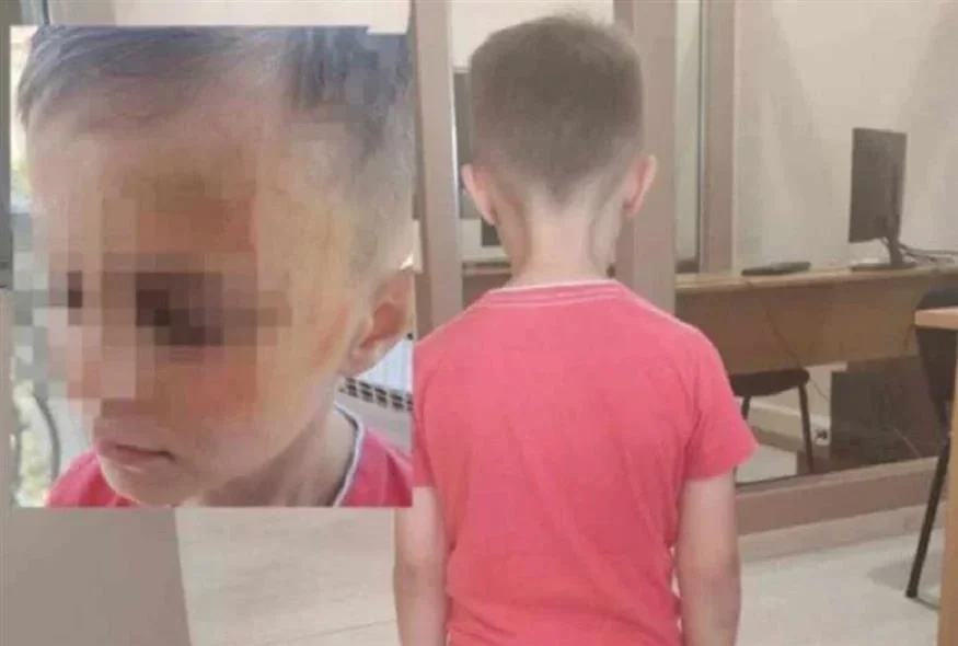 Άγριος ξυλοδαρμός 5χρονου από συμμαθητές του